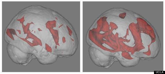 Functional MRI brain scans show how searching the Internet dramatically engages brain neural networks (in red). The image on the left displays brain activity while reading a book; the image on the right displays activity while engaging in an Internet search (Provided by Huffington Post)